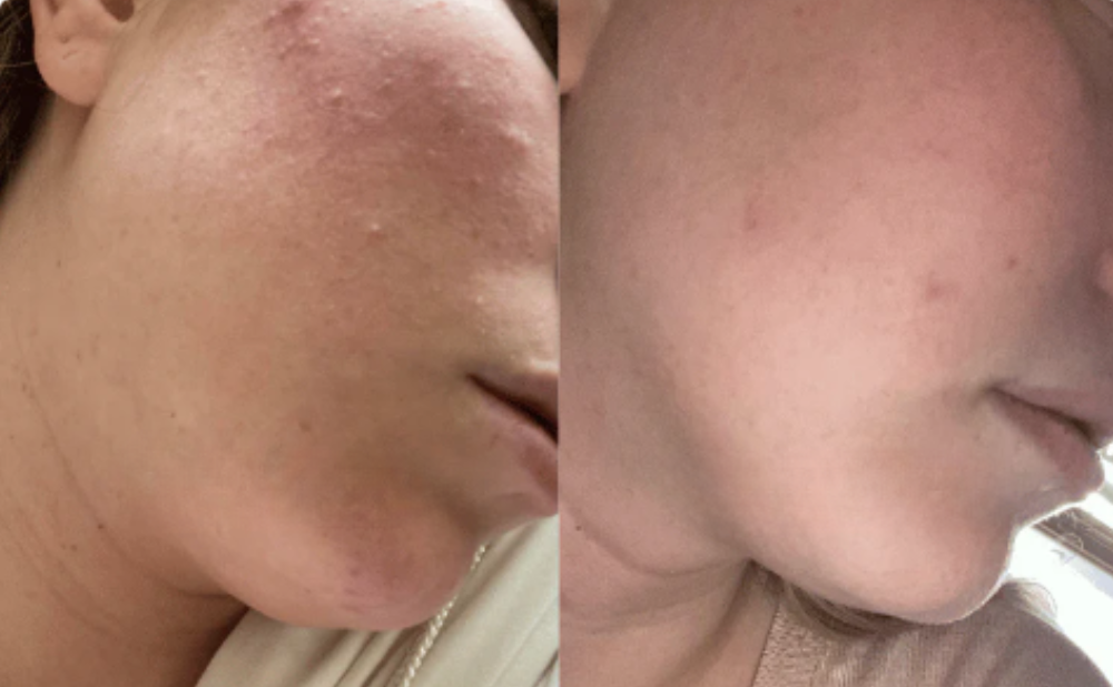 BLUENYA PUREVIA - Pommeau de Douche à double filtration et vitamine C